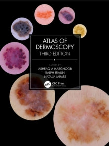 Atlas of Dermoscopy: Third Edition - Agenda Bookshop