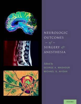 Neurologic Outcomes of Surgery and Anesthesia - Agenda Bookshop