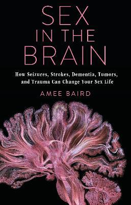 Sex in the Brain: How Seizures, Strokes, Dementia, Tumors, and Trauma Can Change Your Sex Life - Agenda Bookshop