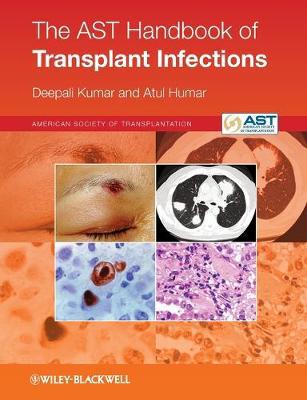 The AST Handbook of Transplant Infections - Agenda Bookshop
