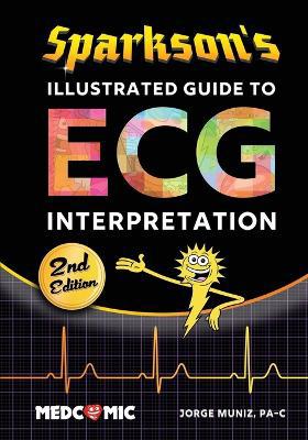 Sparkson''s Illustrated Guide to ECG Interpretation, 2nd Edition - Agenda Bookshop
