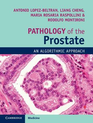 Pathology of the Prostate: An Algorithmic Approach - Agenda Bookshop