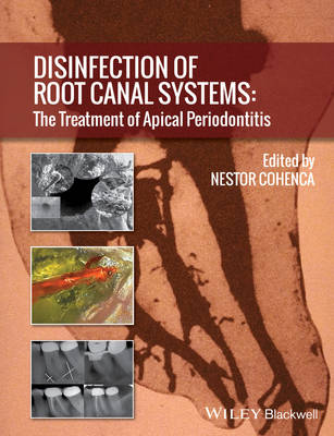 Disinfection of Root Canal Systems: The Treatment of Apical Periodontitis - Agenda Bookshop