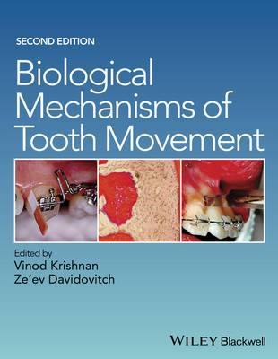 Biological Mechanisms of Tooth Movement - Agenda Bookshop