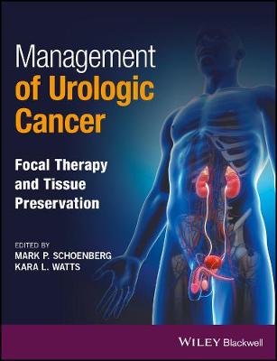 Management of Urologic Cancer: Focal Therapy and Tissue Preservation - Agenda Bookshop