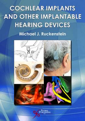 Cochlear Implants and Other Implantable Hearing Devices - Agenda Bookshop