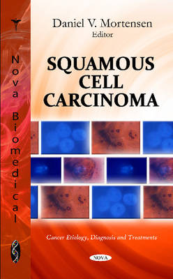 Squamous Cell Carcinoma - Agenda Bookshop