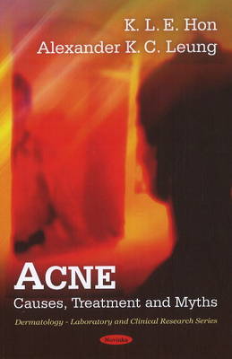 Acne: Causes, Treatment & Myths - Agenda Bookshop