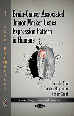 Brain-Cancer Associated Tumor Marker Genes Expression Pattern in Humans - Agenda Bookshop