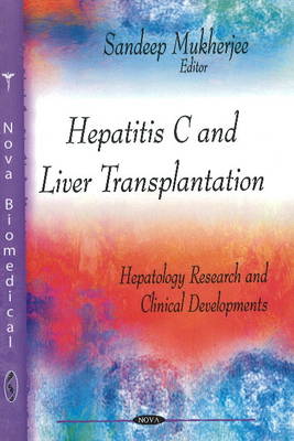 Hepatitis C & Liver Transplantation - Agenda Bookshop