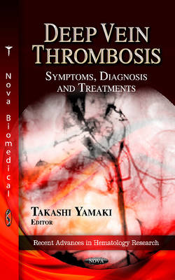 Deep Vein Thrombosis: Symptoms, Diagnosis & Treatments - Agenda Bookshop