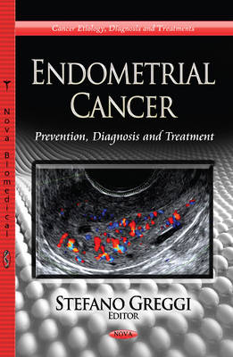 Endometrial Cancer: Prevention, Diagnosis & Treatment - Agenda Bookshop