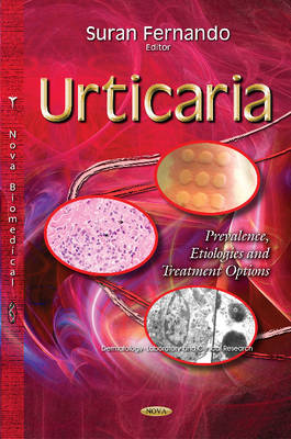 Urticaria: Prevalence, Etiologies & Treatment Options - Agenda Bookshop