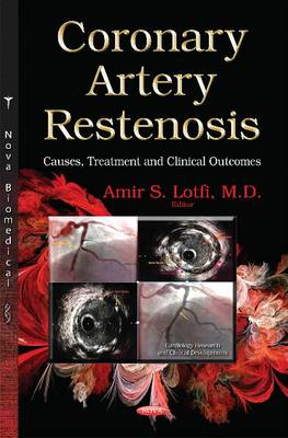 Coronary Artery Restenosis: Causes, Treatment and Clinical Outcomes - Agenda Bookshop