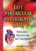 Left Ventricular Hypertrophy (LVH): Prevalence, Risk Factors & Treatment - Agenda Bookshop