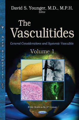 Vasculitides: Volume 1 -- General Considerations & Systemic Vasculitis - Agenda Bookshop