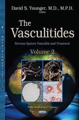 Vasculitidies: Volume 2 -- Nervous System Vasculitis & Treatment - Agenda Bookshop