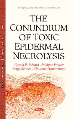 Conundrum of Toxic Epidermal Necrolysis - Agenda Bookshop