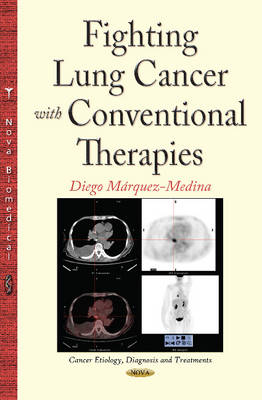 Fighting Lung Cancer with Conventional Therapies - Agenda Bookshop