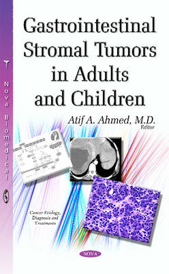Gastrointestinal Stromal Tumors in Adults & Children - Agenda Bookshop