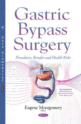 Gastric Bypass Surgery: Procedures, Benefits & Health Risks - Agenda Bookshop
