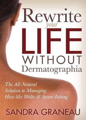 Rewrite Your Life Without Dermatographia: The All-Natural Solution to Managing Hive-like Welts and Severe Itching - Agenda Bookshop