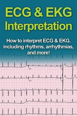 ECG & EKG Interpretation: How to interpret ECG & EKG, including rhythms, arrhythmias, and more! - Agenda Bookshop