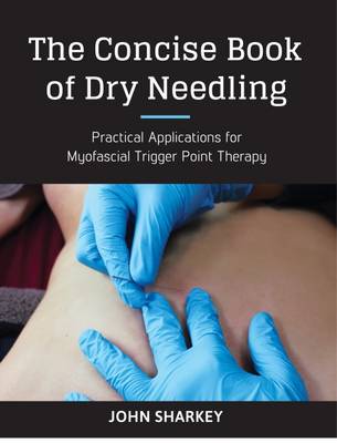 The Concise Book of Dry Needling: A Practitioner''s Guide to Myofascial Trigger Point Applications - Agenda Bookshop