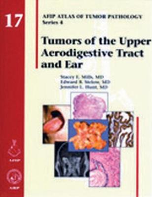 Tumors of the Upper Aerodigestive Tract and Ear - Agenda Bookshop