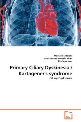 Primary Ciliary Dyskinesia / Kartagener''s Syndrome - Agenda Bookshop