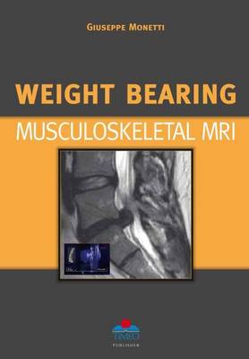 Weight Bearing Musculoskeletal MRI - Agenda Bookshop