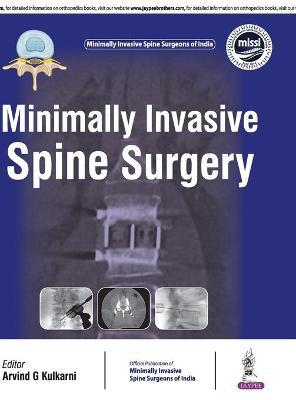 Minimally Invasive Spine Surgery - Agenda Bookshop